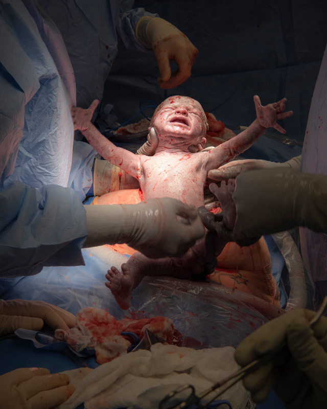 Bebé_nacido_de_utero_trasplantado.jpg