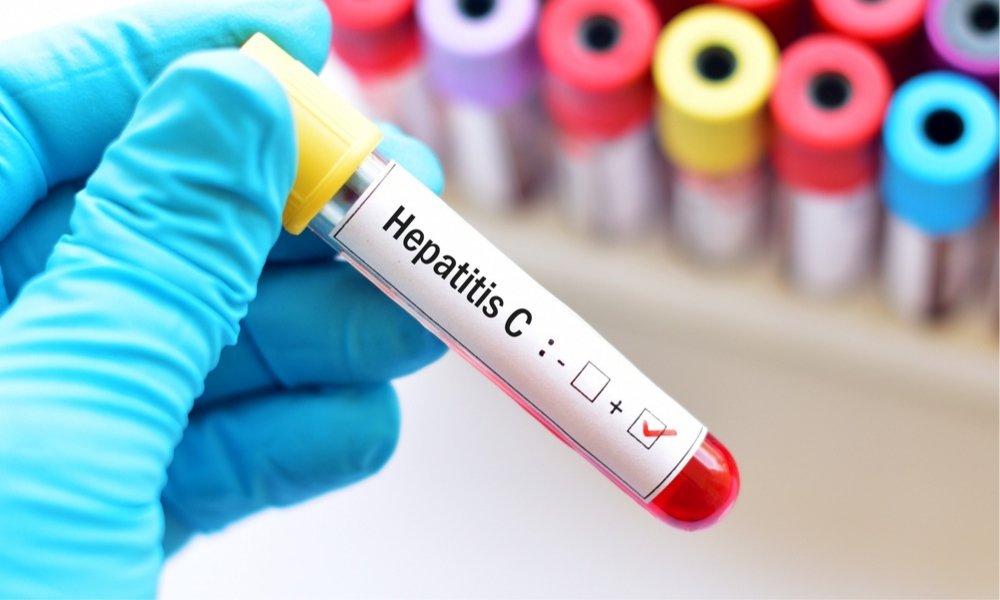 hepatitis-c-tratamiento-gr.jpg