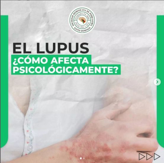 lupuspsicologia.JPG