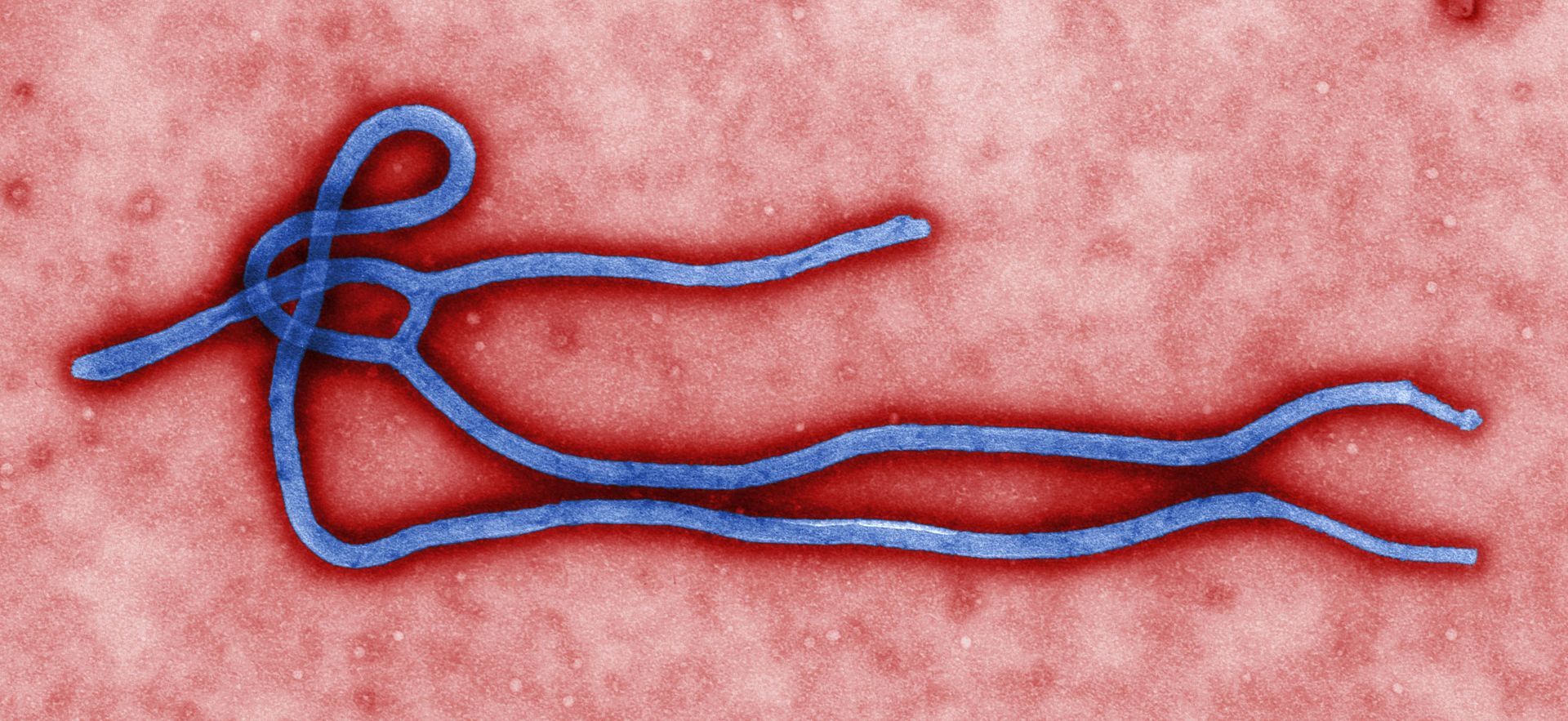 Electron-Micrograph-of-an-Ebola-virus-virion.jpg
