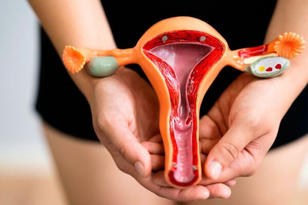 ovario poliquístico