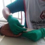 Realizarán campaña “Hepatitis Cero” para educar población (VIDEO) 