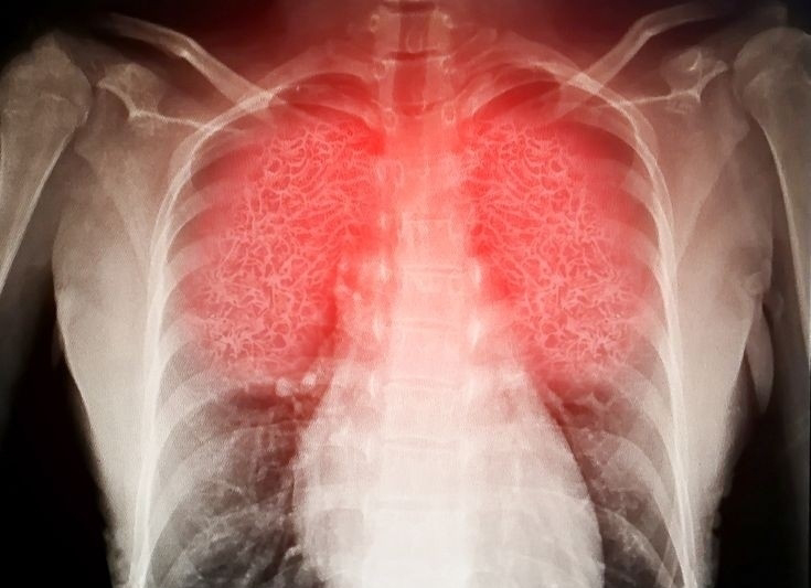 Científicos descubren que desodorantes depositan partículas en nuestros pulmones